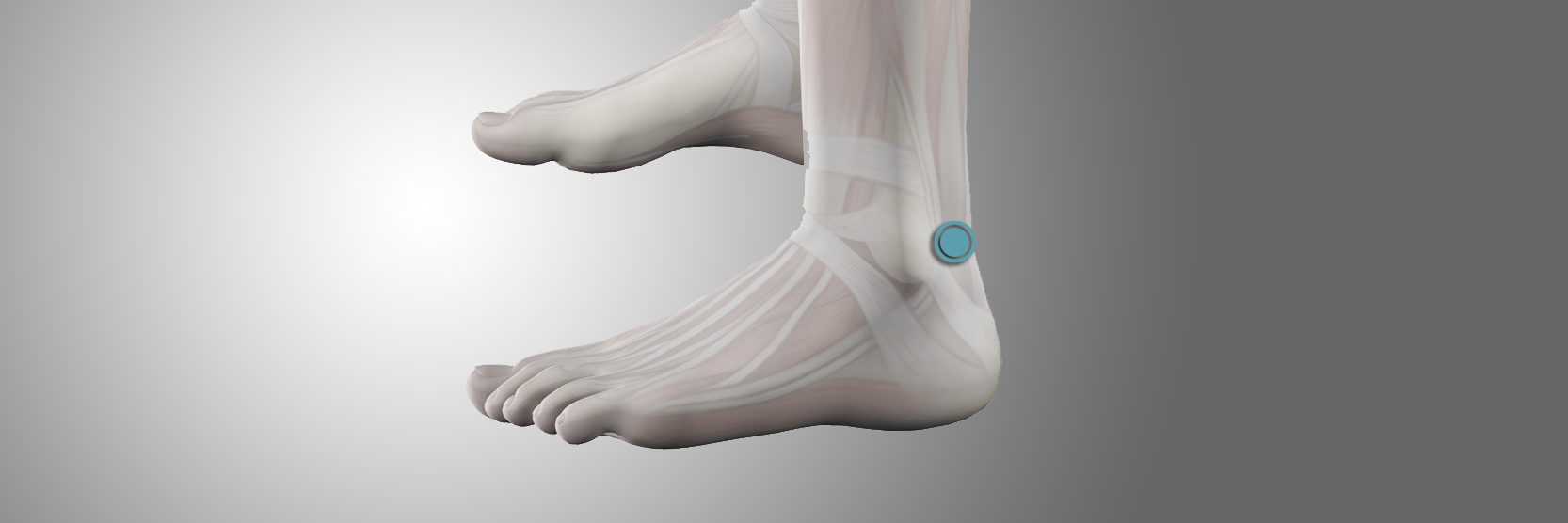 Heel Pain, Heel Spurs and Plantar Fasciitis - Podiatry of Greater Cleveland